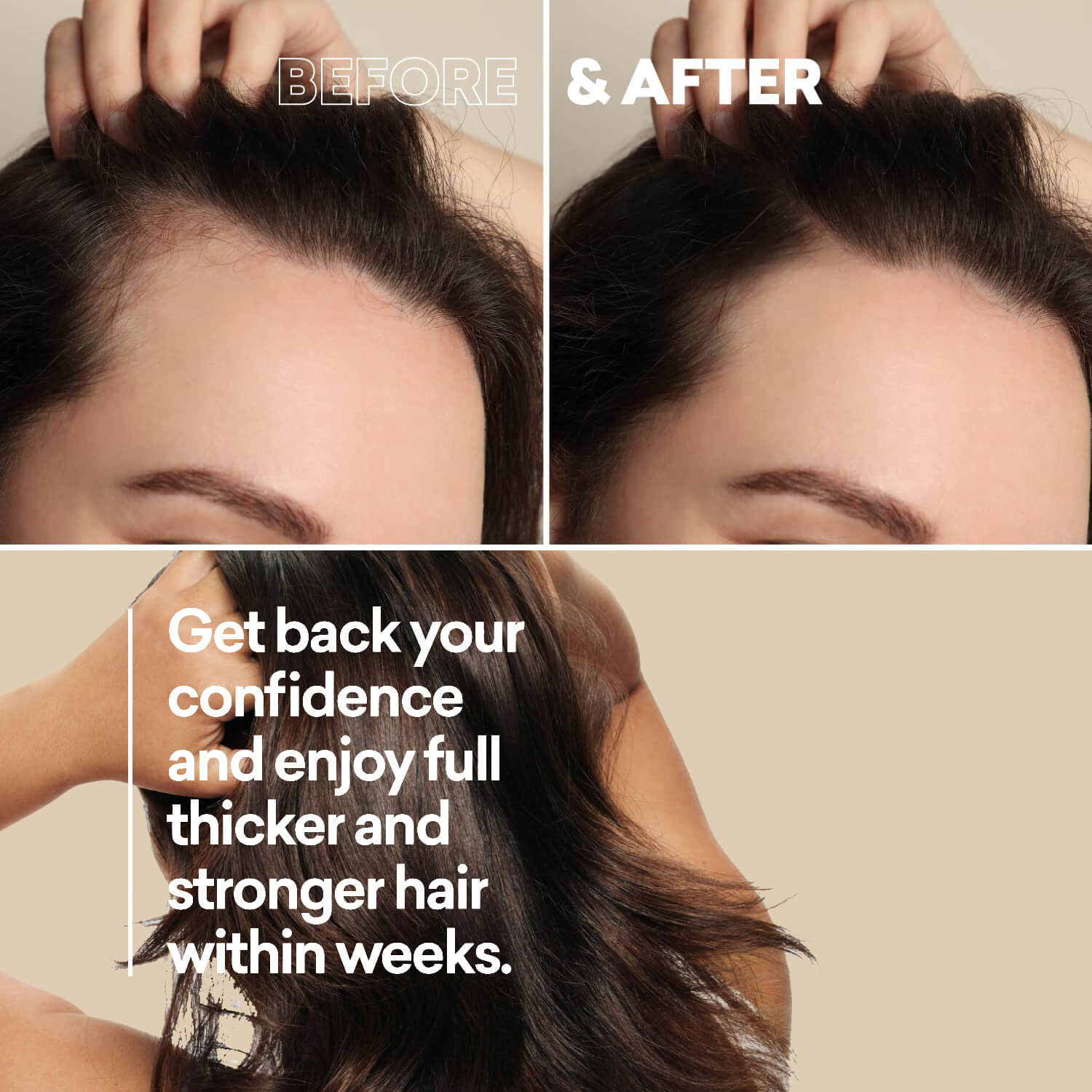 Fermented Rice Water Hair Growth Spray For Thinning Hair And Hair Loss  Treatment Hair Spray